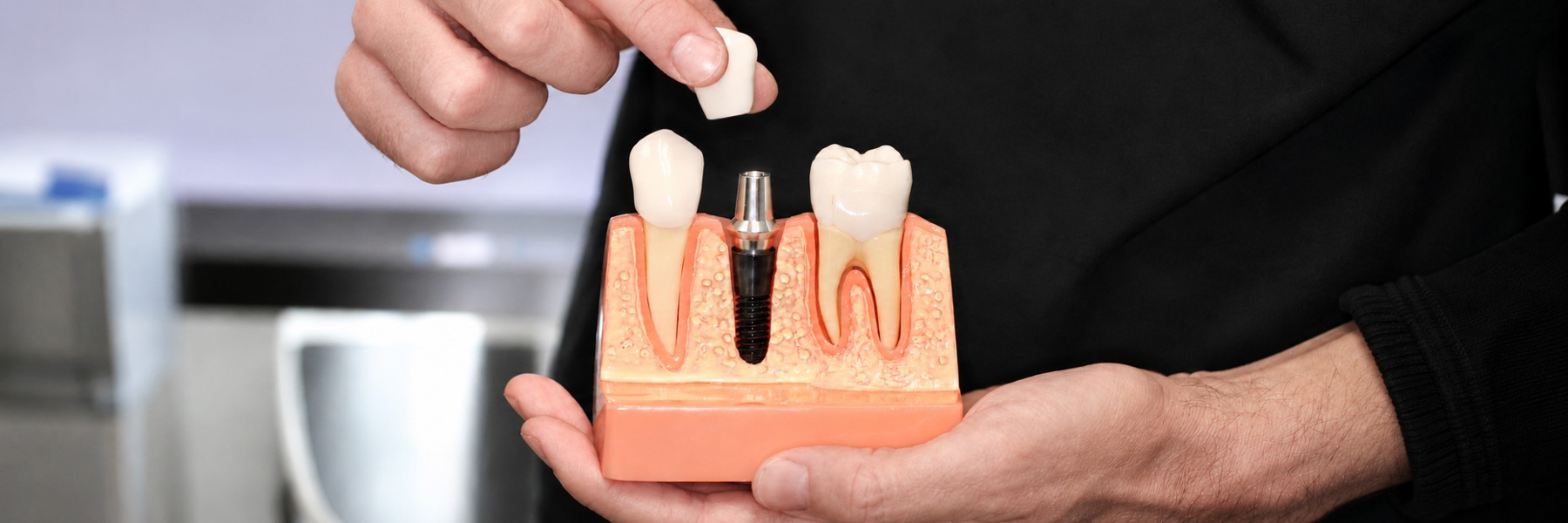 Dental implant restoration demonstration at Hudzinski Dental in Mayfield Heights, Ohio