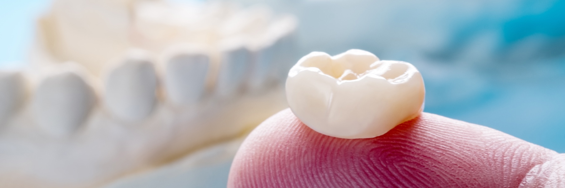 CEREC® Crowns and Bridges | Dentist
